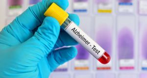 Τεστ αίματος εντοπίζει το Αλτσχάιμερ 16 χρόνια πριν εμφανιστούν τα…