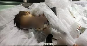 Τουρκία – Φρίκη! Νεκρό μωρό σε αιματηρά αντίποινα στον Ερντογάν!…
