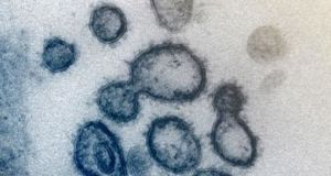 Επιστήμονες «φωτογράφισαν» τον Covid-19 – Οι πρώτες εικόνες από μικροσκόπιο