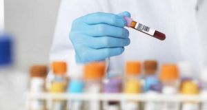 Γαλλία: Ξεκινούν κλινικές δοκιμές για την θεραπεία του κορωνοϊού