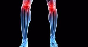 Πόνος στα γόνατα: Ποια σωματική αδυναμία φανερώνει