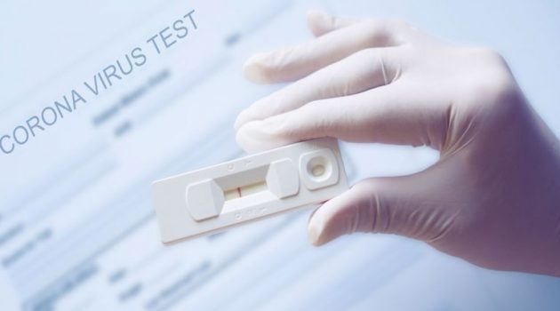 Ναύπακτος: Δωρεάν Rapid Tests την Δευτέρα από τον Ε.Ο.Δ.Υ.