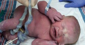 Ασπρόπυργος: Γυναίκα βρήκε νεογέννητο με τον ομφάλιο λώρο