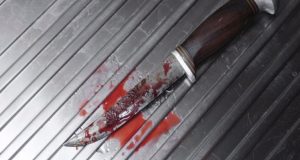 Θεσσαλονίκη: Γυναίκα μαχαίρωσε τον σύζυγό της έπειτα από καβγά
