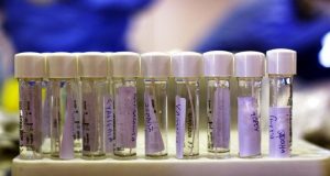 Κορωνοϊός: Νέο τεστ ανιχνεύει τα αντισώματα στα ούρα και όχι…
