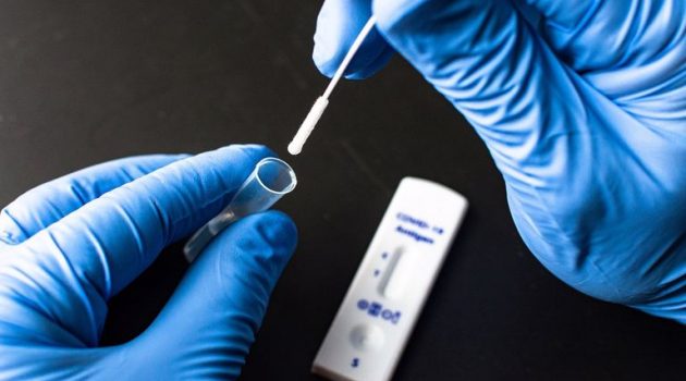 Ώρα αποφάσεων για rapid tests ανεμβολίαστων εργαζόμενων – Μέχρι πότε θα ισχύει