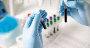 Κορωνοϊός: Έρχεται το πρώτο τεστ αίματος που θα προβλέπει ποιος…