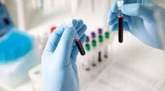 Κορωνοϊός: Έρχεται το πρώτο τεστ αίματος που θα προβλέπει ποιος κινδυνεύει με long covid