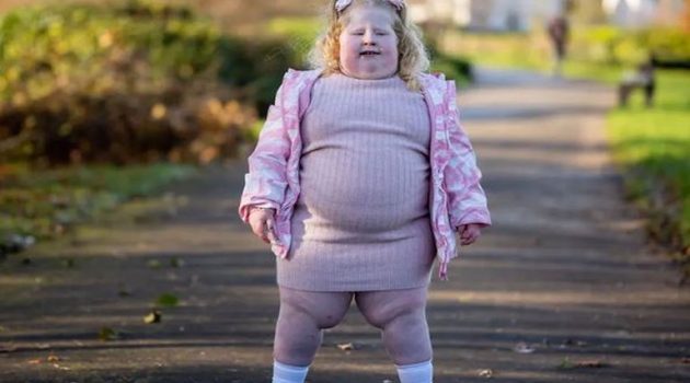 Μεγάλη Βρετανία: Η 5χρονη που ζυγίζει 45 κιλά και το σύνδρομο που την κάνει να πεινάει