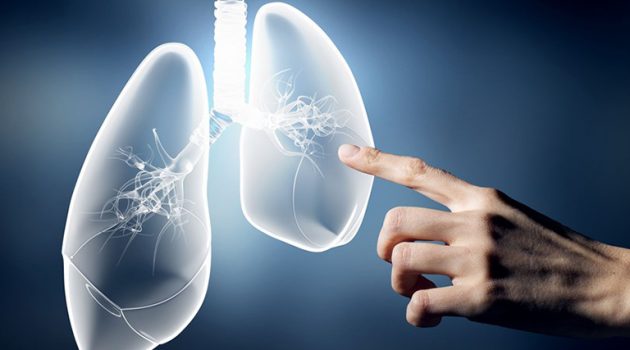 Αγρίνιο: Ημερίδα ενημέρωσης για την έγκαιρη διάγνωση του καρκίνου του πνεύμονα
