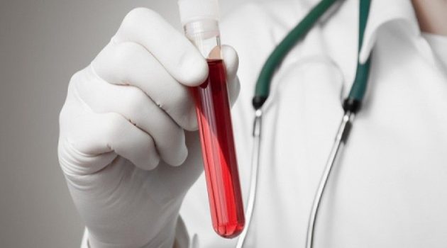 Αγρίνιο – Ιατρικός Σύλλογος: «Η προσφορά αίματος είναι μία πράξη αλληλεγγύης»