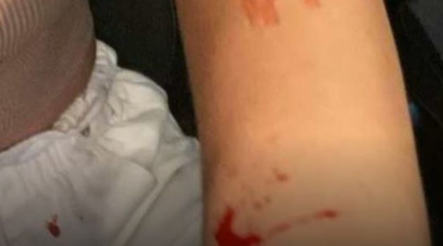 Βόλος: Διεθνής Αθλητής επιτέθηκε άγρια στη σύζυγό του (Photos)