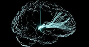 Πειραματική συσκευή βελτιώνει τη λειτουργία του εγκεφάλου σε ασθενείς με…