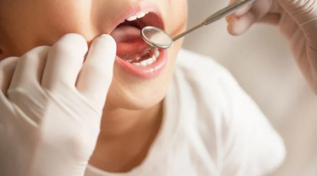 Dentist Pass: Τι παρέχει και πότε λήγει η προθεσμία για τις αιτήσεις