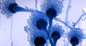 ΗΠΑ -Μελέτη: Ανακαλύφθηκαν μικροοργανισμοί που ευθύνονται για τις ρυτίδες του…