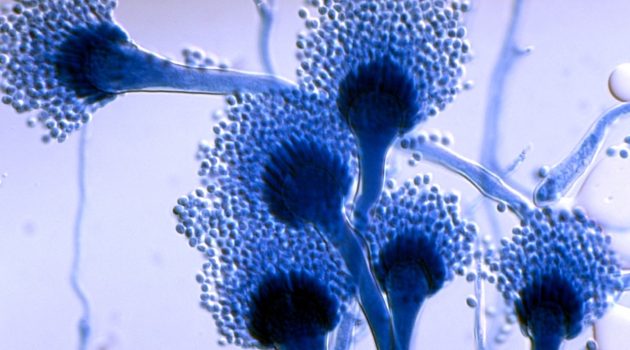 ΗΠΑ -Μελέτη: Ανακαλύφθηκαν μικροοργανισμοί που ευθύνονται για τις ρυτίδες του προσώπου