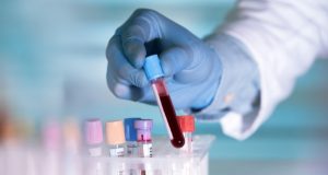 Βρετανοί επιστήμονες ανακάλυψαν εξέταση αίματος που μπορεί να διαγνώσει ορισμένους…