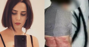 Ιράν: Ποια είναι η γυναίκα που μαστιγώθηκε 74 φορές επειδή…