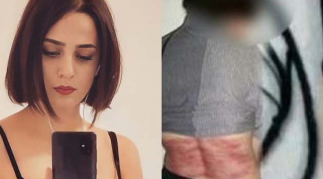 Ιράν: Ποια είναι η γυναίκα που μαστιγώθηκε 74 φορές επειδή αρνείται το χιτζάμπ
