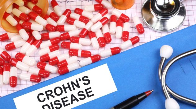 Νόσος του Crohn: Φάρμακο μειώνει την ανάγκη για χειρουργική επέμβαση