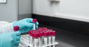 Ερευνητές αναπτύσσουν εξέταση αίματος που θα προβλέπει τον κίνδυνο εμφάνισης…