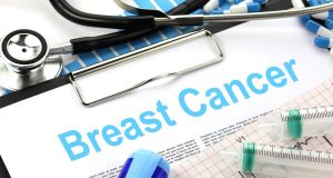 Μελέτη: Ο ετήσιος προσυμπτωματικός έλεγχος για καρκίνο του μαστού από…