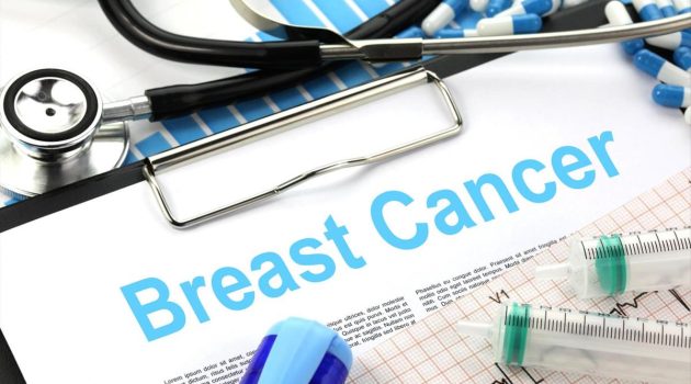 Μελέτη: Ο ετήσιος προσυμπτωματικός έλεγχος για καρκίνο του μαστού από τα 40 σώζει ζωές