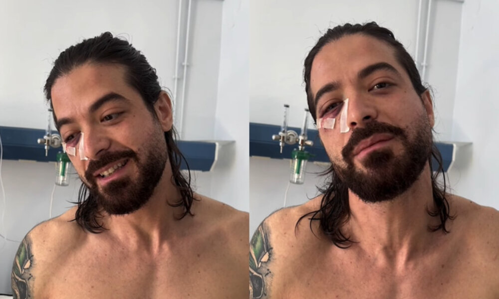 Ο Άρης Μουγκοπέτρος προχώρησε σε ανάρτηση μέσω Instagram για την περιπέτεια της υγείας του μετά την έκρηξη κροτίδας στα Τριπόταμα Αχαΐας.