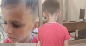 Σε Νηπιαγωγείο του Αγρινίου το πρωί της 10ης Ιουνίου 2025 έδειραν ένα αγόρι 5 ετών, σοκαρισμένη η μητέρα του κατήγγειλε το περιστατικό.