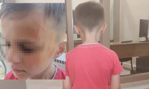 Σε Νηπιαγωγείο του Αγρινίου το πρωί της 10ης Ιουνίου 2025 έδειραν ένα αγόρι 5 ετών, σοκαρισμένη η μητέρα του κατήγγειλε το περιστατικό.