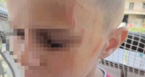 Ενδοσχολική Βία ξανά στο Αγρίνιο, την Πέμπτη, 12 Ιουνίου θα γίνει η έκτακτη σύσκεψη για τον ξυλοδαρμό 5χρονου.