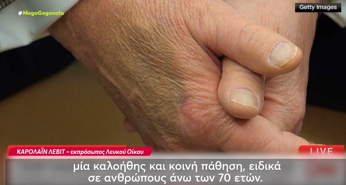Ο Ντόναλντ Τραμπ πάθει από χρόνια φλεβική ανεπάρκεια, όπως ανακοίνωσε και ο Λευκός Οίκος δίνοντας επιλέον εξηγήσεις.