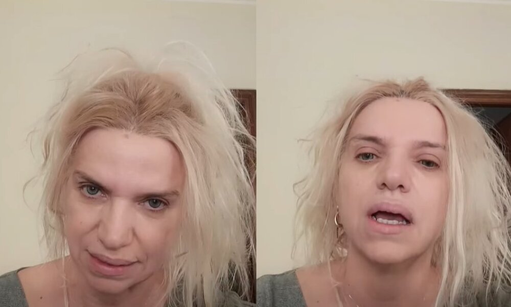 Η Αγρινιώτισσα Οδοντίατρος Εύη Βέρρη μέσω ενώ βίντεο από το Τορίνο της Ιταλίας τοποθετήθηκε λεπτομερώς για τον 18χρονο Μάριο τον οποίον όπως είπε τον οδήγησαν εκεί τα ιατρικά λάθη.