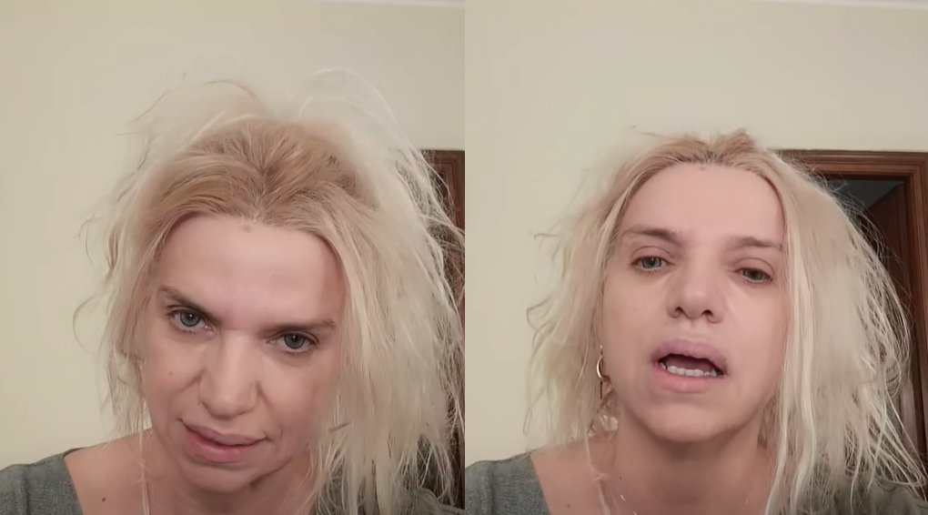 Η Αγρινιώτισσα Οδοντίατρος Εύη Βέρρη μέσω ενώ βίντεο από το Τορίνο της Ιταλίας τοποθετήθηκε λεπτομερώς για τον 18χρονο Μάριο τον οποίον όπως είπε τον οδήγησαν εκεί τα ιατρικά λάθη.